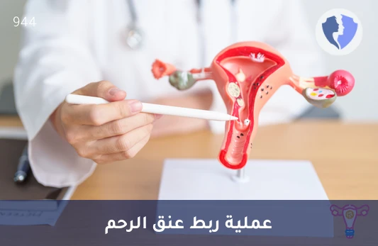 عملية ربط عنق الرحم