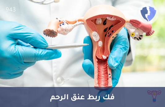 فك غرزة ربط عنق الرحم - عملية فك ربط عنق الرحم