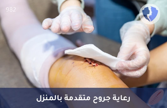 غيار جروح الدرجة الثالثة بالمنزل - غيار جروح الدرجة الثالثة في المنزل