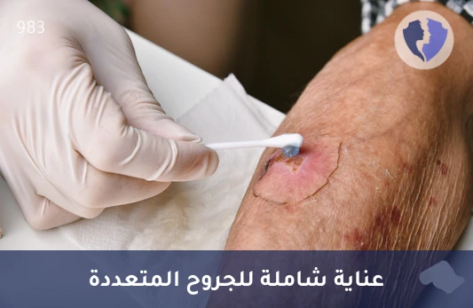 غيار الجروح الكبيرة والمتعددة - غيار جروح كبيرة ومتعددة في المنزل