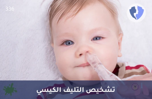 فحص التليف الكيسي الشامل - فحص التليف الكيسي (Cystic Fibrosis)