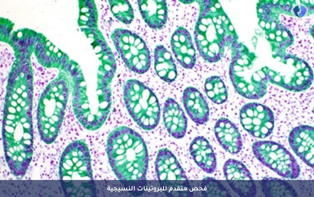 الفحص المناعي السداسي للأنسجة - فحص الكيمياء النسيجية المناعية (IHC) - 6 مؤشرات