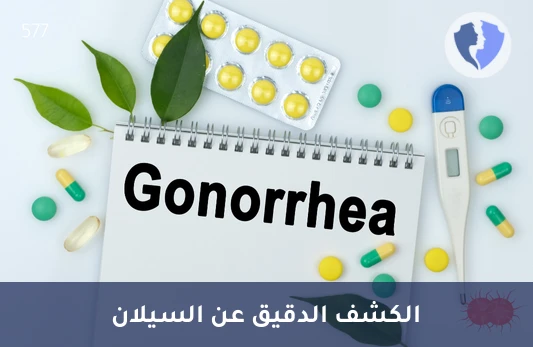 الفحص السريع لمرض السيلان - فحص بكتيريا السيلان بتقنية (Real Time PCR)