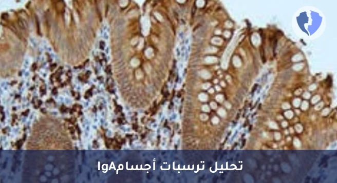 فحص ترسبات الأجسام المضادة IgA