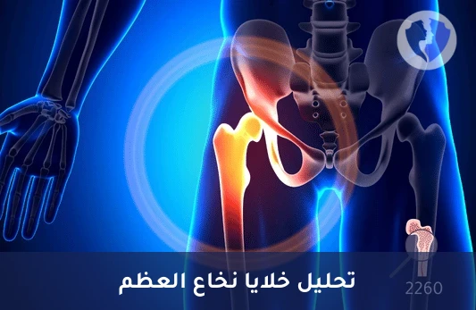 فحص نخاع العظم الدقيق - فحص خزعة نخاع العظم (Bone Marrow Aspiration)
