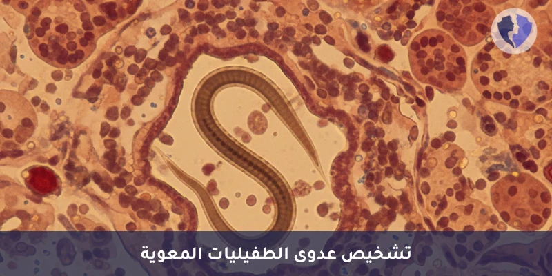 فحص عدوى الديدان الخيطية - فحص داء السترونجيلويدس (Strongyloidiasis)