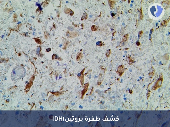 فحص الطفرات الجينية لأورام الدماغ - فحص طفرة IDH1 الكيميائي النسيجي المناعي (IDH1)