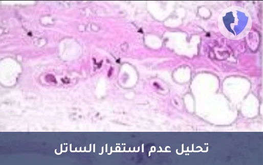 فحص استجابة العلاج المناعي للسرطان - فحص عدم استقرار الساتل الميكروي (MSI)