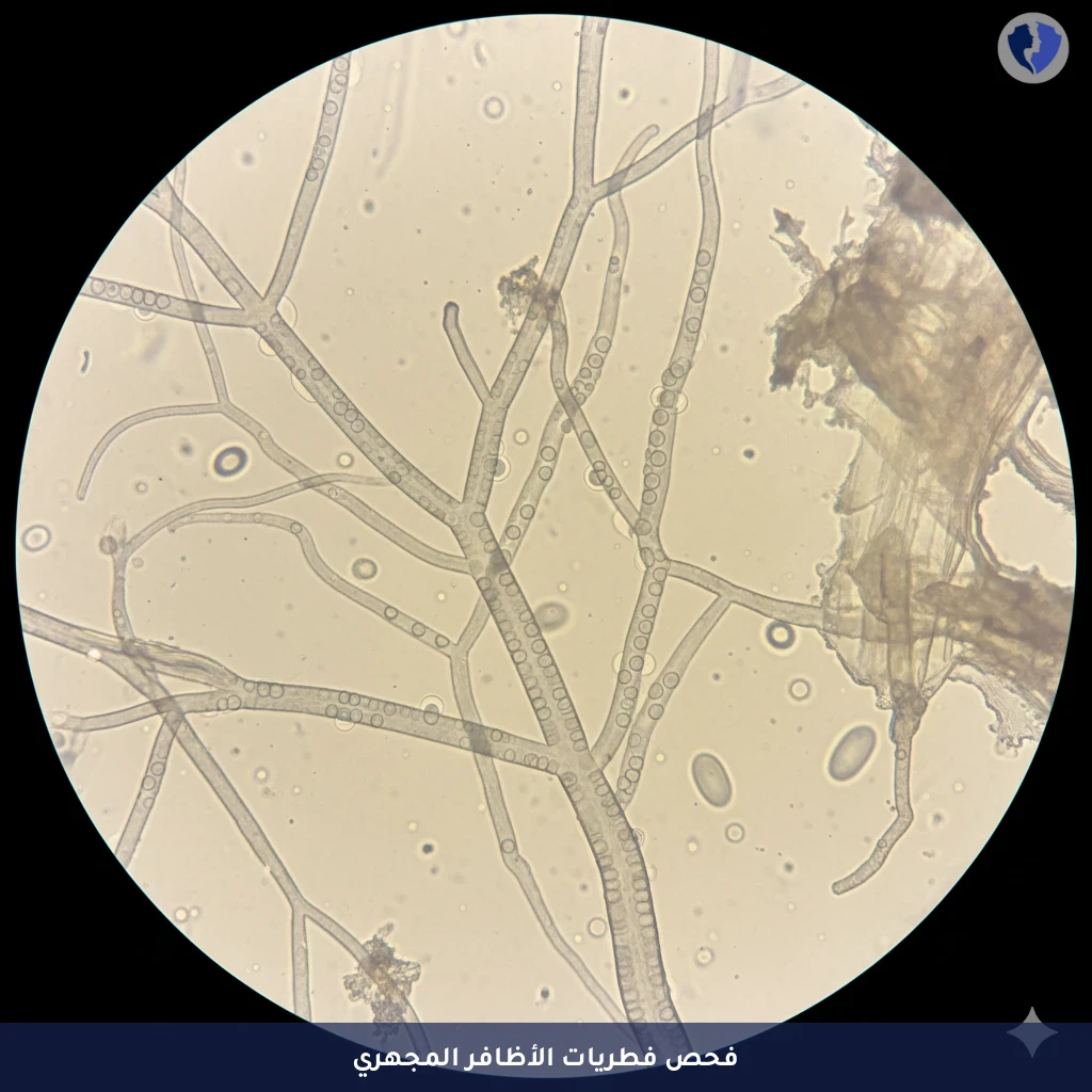 فحص فطريات الأظافر السريع - فحص فطريات الأظافر المجهري (KOH)