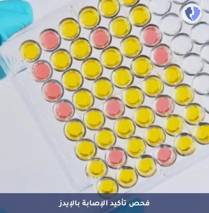 فحص تأكيد فيروس نقص المناعة - فحص فيروس نقص المناعة البشرية التأكيدي (HIV Western Blot)