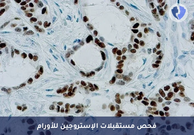 فحص مستقبلات الإستروجين للثدي - فحص كيميائي نسيجي مناعي لمستقبلات الإستروجين (ER)