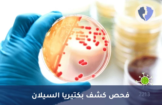 فحص السيلان المجهري السريع - فحص مسحة بكتيريا السيلان (Neisseria gonorrhoeae)