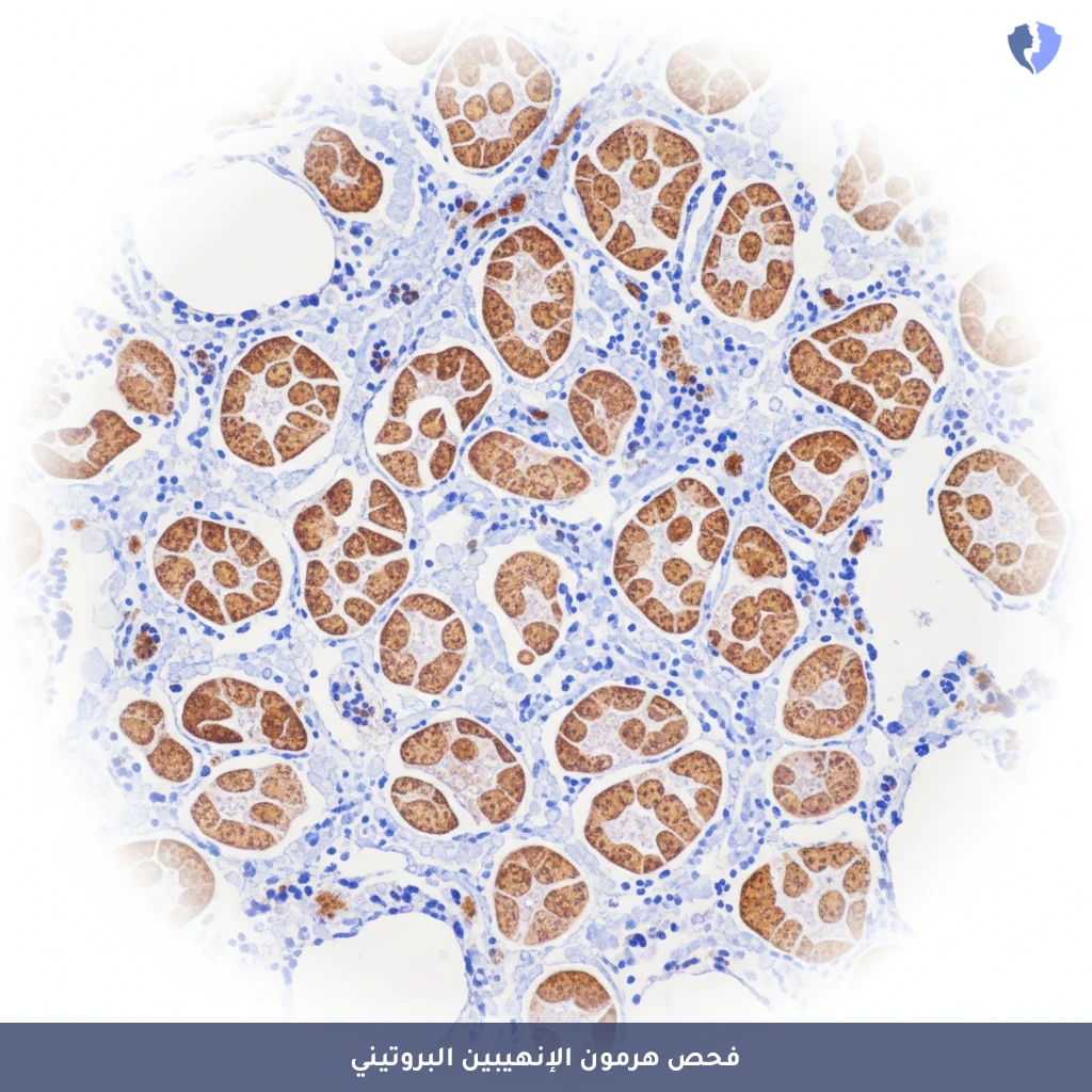 فحص دلالات أورام المبيض والخصية - فحص هرمون الإنهيبين الكيميائي النسيجي المناعي (Inhibin)