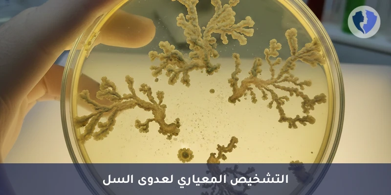 مزرعة بكتيريا الدرن الدقيقة - مزرعة بكتيريا الدرن (TB Culture)