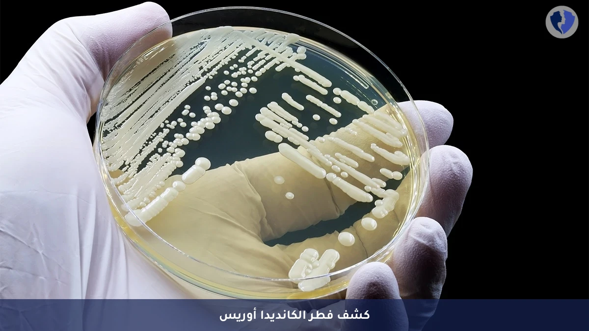 فحص فطر الكانديدا أوريس - مزرعة فطريات للتعرف على فطر الكانديدا أوريس (C. Auris)