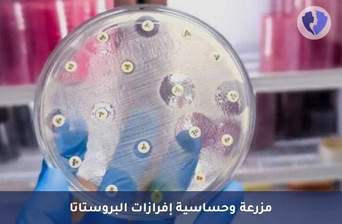 مزرعة إفرازات البروستاتا - مزرعة وحساسية إفرازات البروستاتا