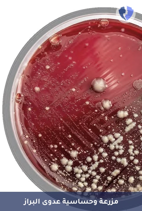 مزرعة براز شاملة - مزرعة وحساسية البراز