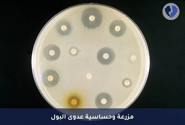 فحص ومزرعة البول الشامل - مزرعة وحساسية البول