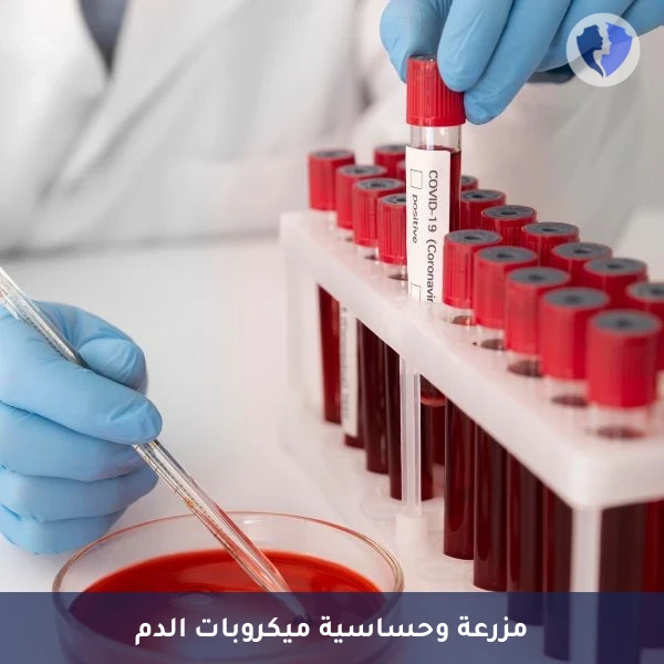 مزرعة دم وتحديد المضاد - مزرعة وحساسية الدم