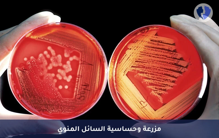 مزرعة سائل منوي دقيقة - مزرعة وحساسية السائل المنوي